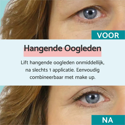 Instant Lifting Eyelids Set