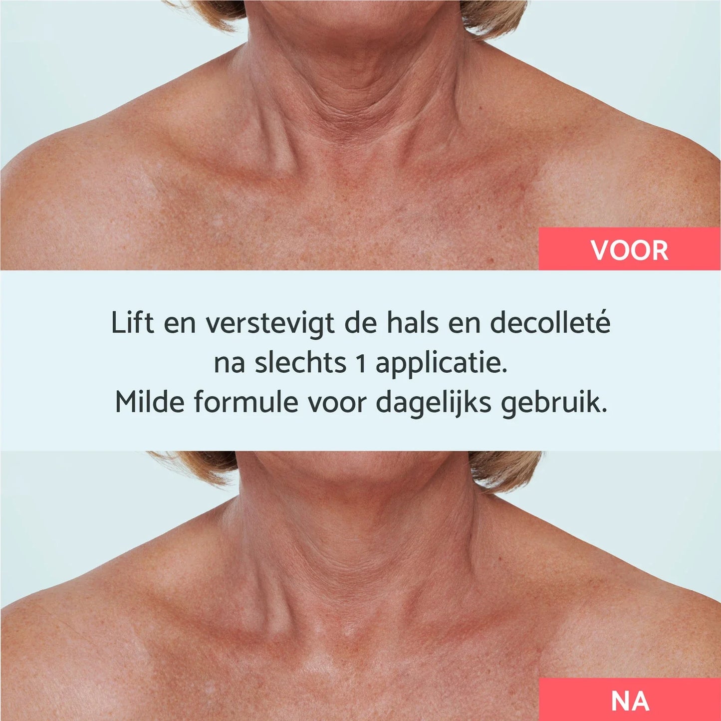 Neck & Décolleté - Instant Lifting