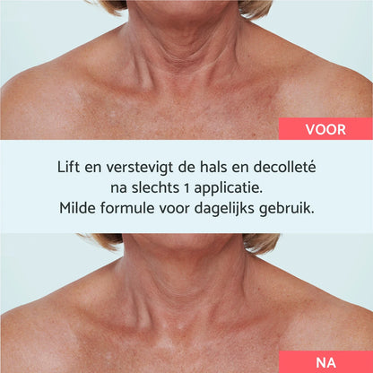 Neck & Décolleté - Instant Lifting