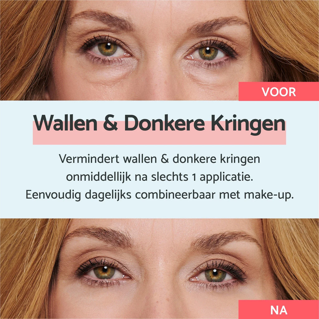 Eye Bags & Dark Circles